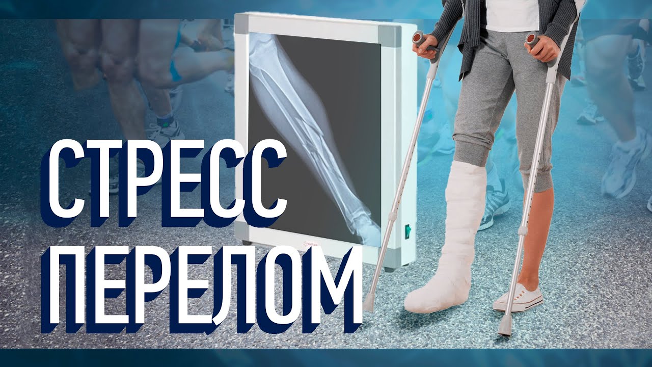 Стресс перелом. Травмы не было, но она есть!