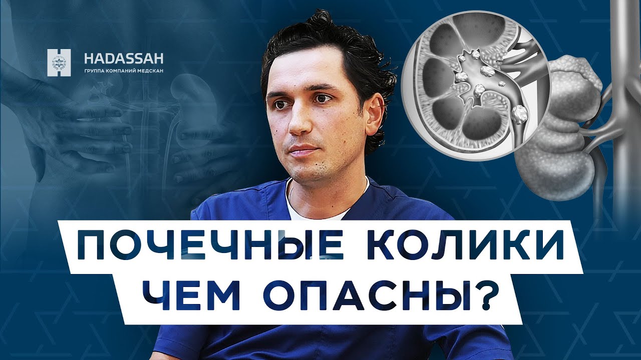 Что делать при возникновении почечных колик? Диагностика и лечение / Hadassah Medical Moscow