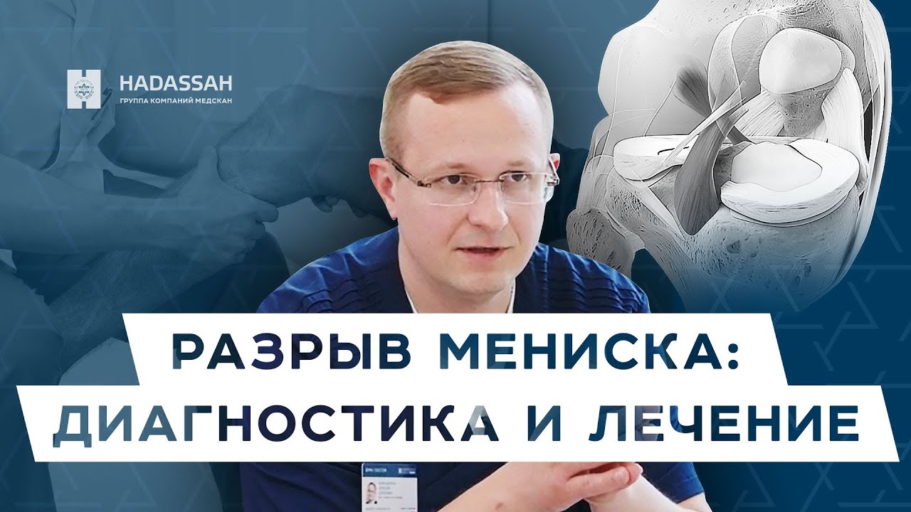 Что делать при разрыве мениска? Когда нужно делать операцию? Hadassah Medical Moscow