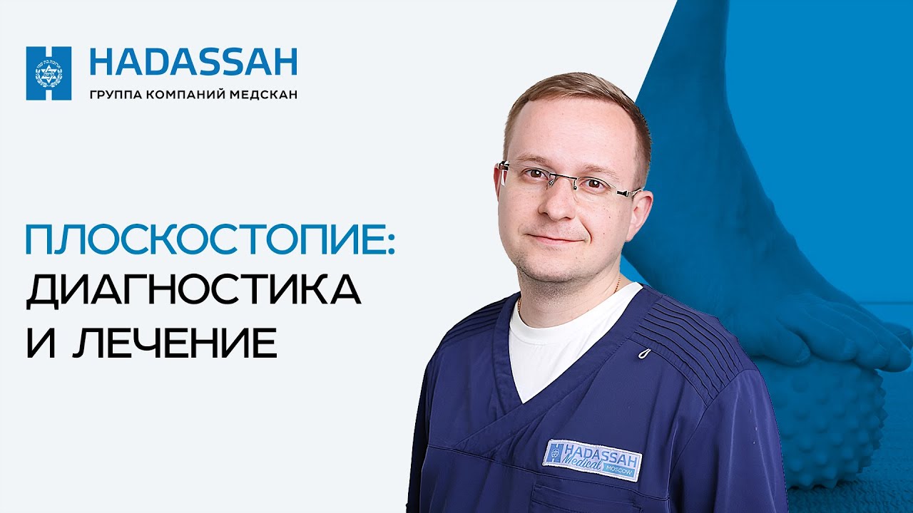 Почему возникает плоскостопие и можно ли его вылечить? Hadassah Medical Moscow