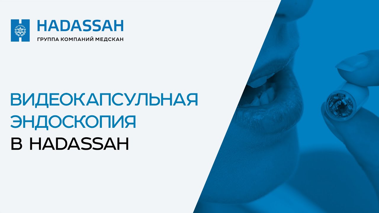 Как проходит видеокапсульная эндоскопия и нужно ли к ней готовиться?