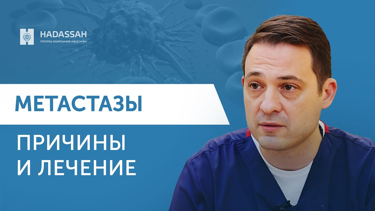 Когда и где появляются метастазы? Как проходит лечение и удаление метастаз? Все о метастазах